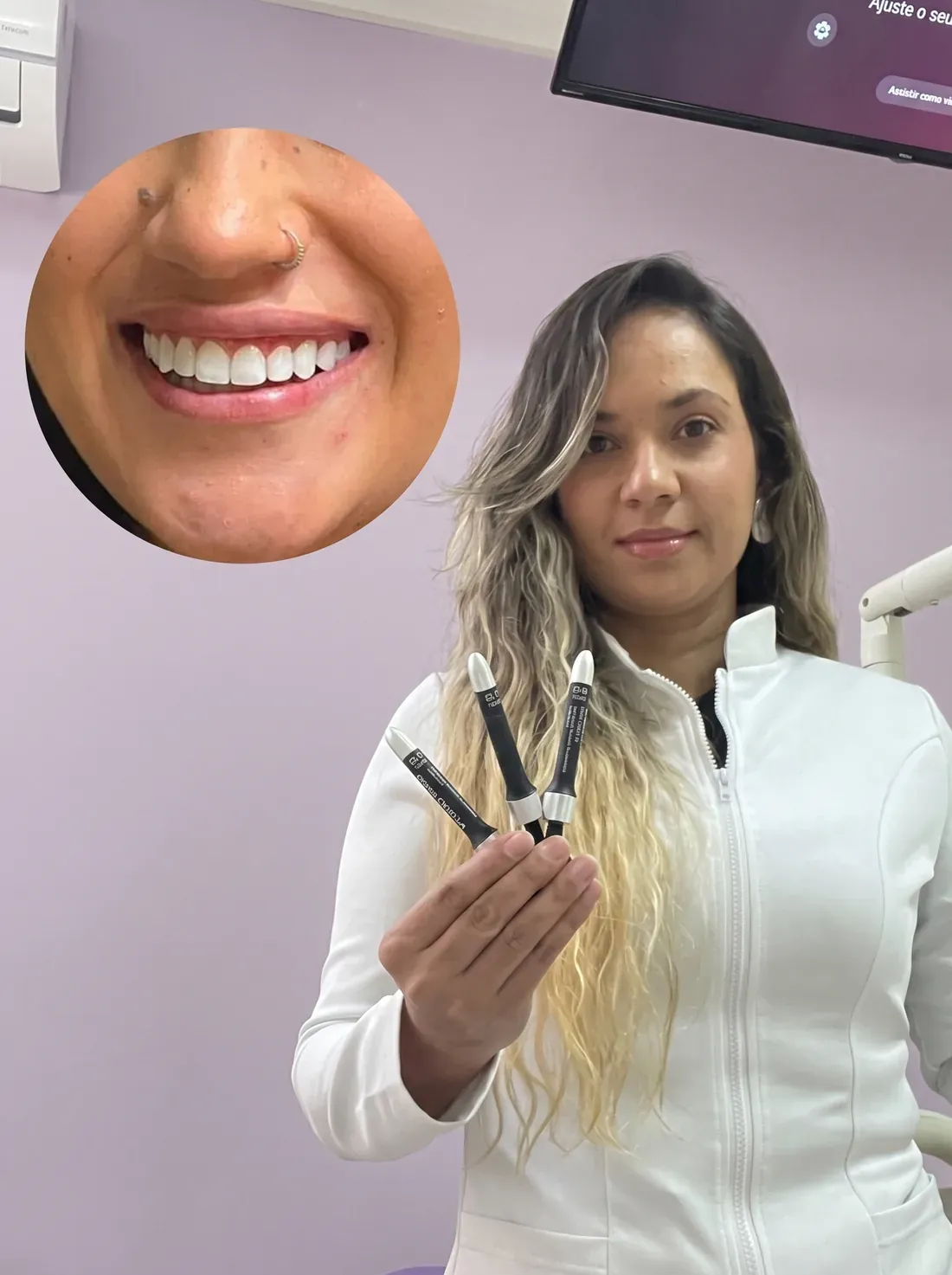 Dra. Amanda Tainara segurando resinas usadas em facetas